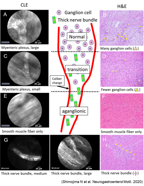 腸管神経可視化に関する研究