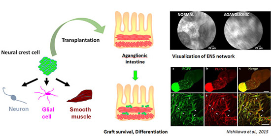 神経堤幹細胞を用いた腸管神経再生に関する研究